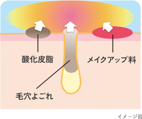イメージ図